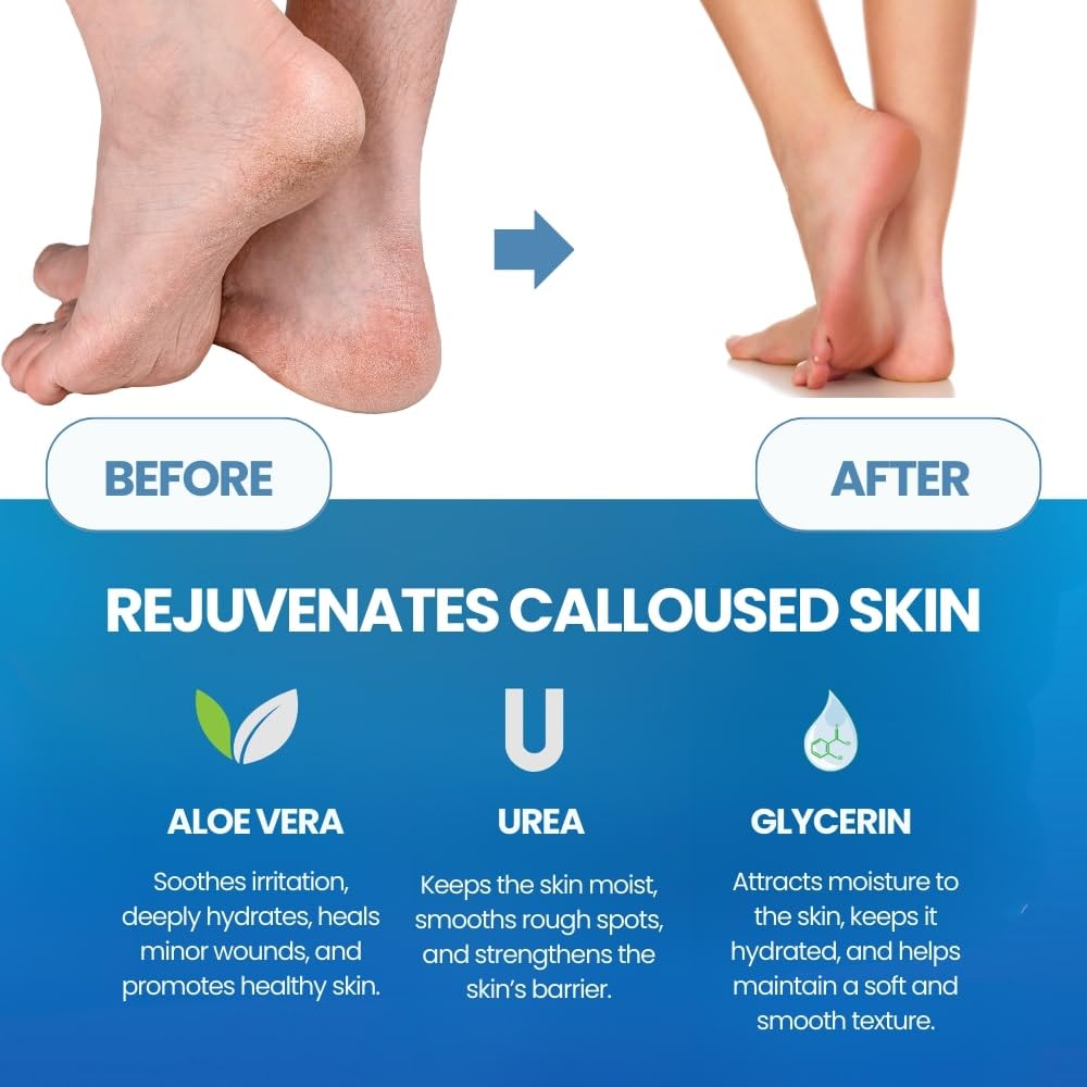 Removedor de Cutículas e Pele  - Foot Mask Peeling avaliação e preço