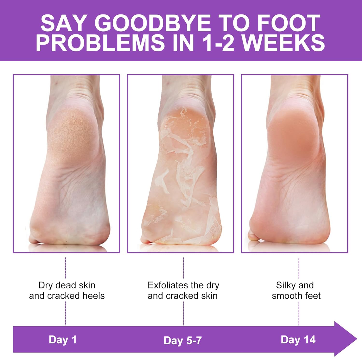 Meias Esfoliantes para Remover - Foot Mask Peeling avaliação e preço