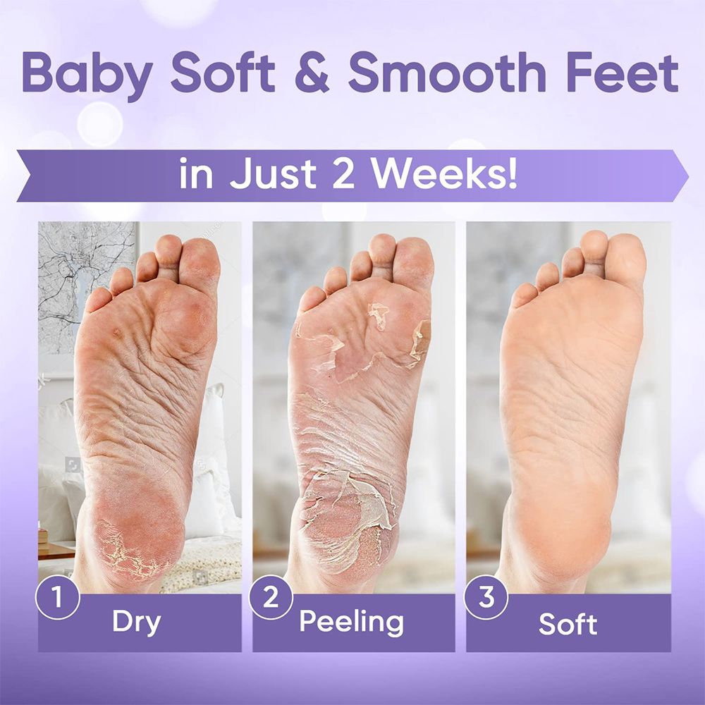 1-20 pares esfoliante pés másc - Foot Mask Peeling avaliação e preço