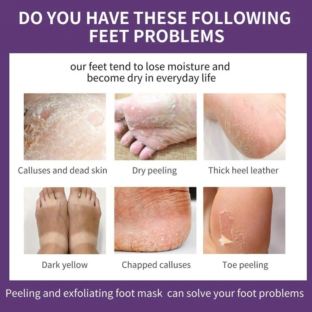 Máscara Esfoliante Hidratante  - Foot Mask Peeling avaliação e preço